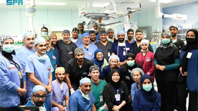نجاح فصل التوأم السيامي التنزاني "حسن وحسين" بعد عملية جراحية معقدة استغرقت 16 ساعة