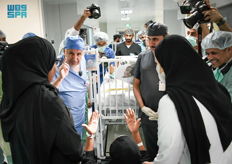 نجاح فصل التوأم السيامي التنزاني "حسن وحسين" بعد عملية جراحية معقدة استغرقت 16 ساعة