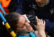 اصطدمت بالكاميرا إصابة دامية لحكمة مباراة ريال بيتيس وبلباو في الدوري الإسباني