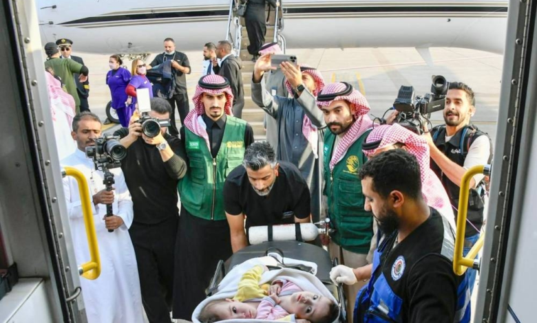 إنفاذا لتوجيهات القيادة وصول التوأم الملتصق السوري "سيلين وإيلين" إلى الرياض